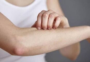 Psoriasis ar an lámh
