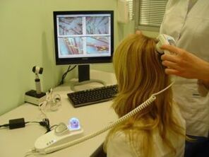 Diagnóis psoriasis ar an scalp