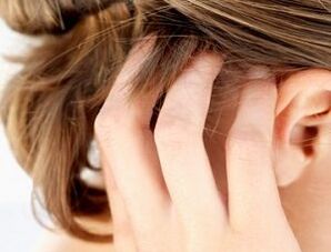 comharthaí agus comharthaí psoriasis ar an scalp